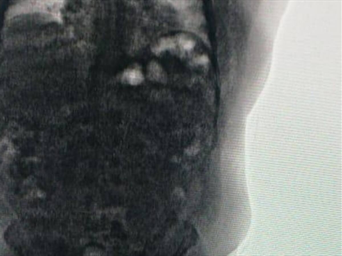 Capturan a dos extranjeros con 1.5 kilos de cocaína en el aeropuerto Ernesto Cortissoz