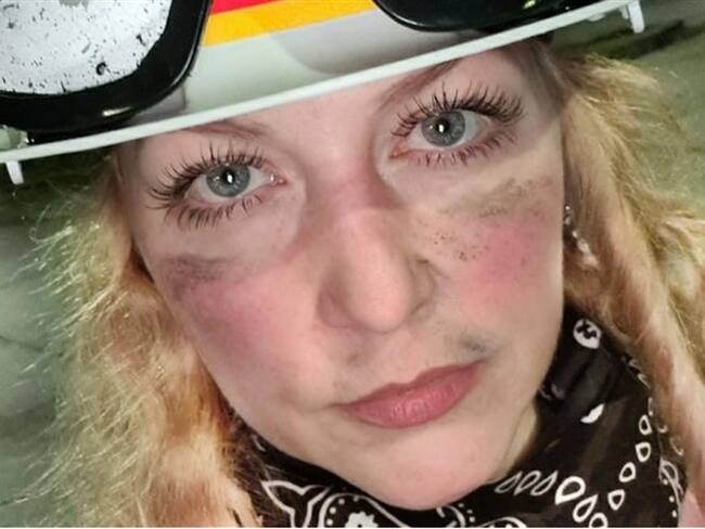 Gobierno confirma expulsión de alemana que se unió a la Primera Línea de Cali. Foto: Facebook: Rebecca Sprösser