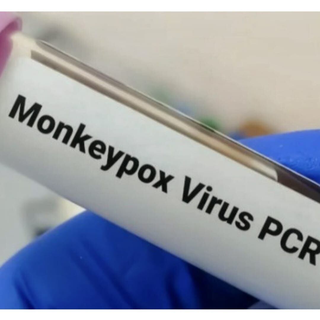 Se realizan investigaciones de campo para hacer los cercos epidemiológicos. Crédito: Gobernación del Cauca.