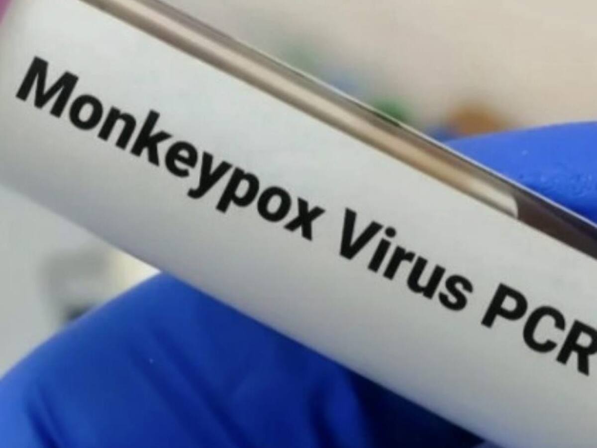 Se confirmó el primer caso positivo de viruela símica en el Cauca