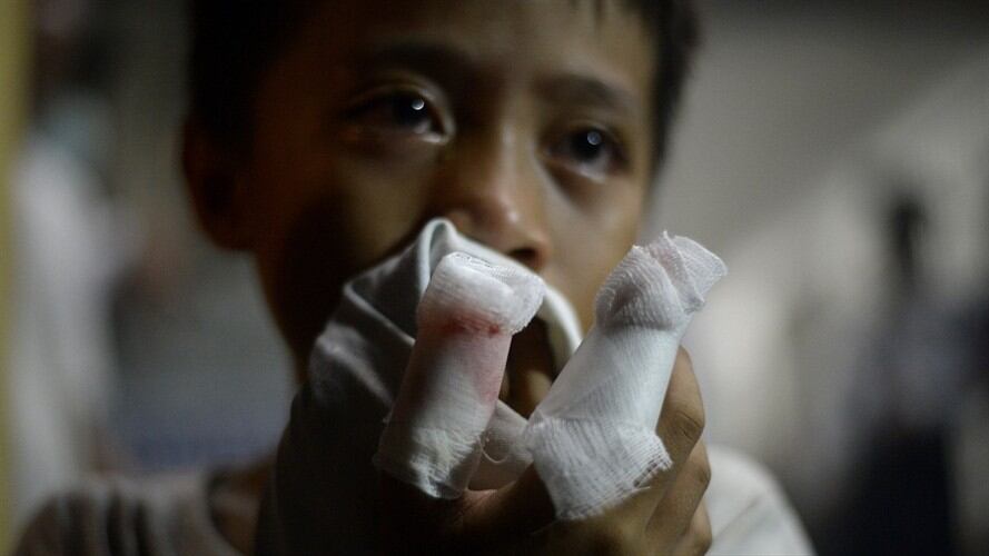 En la noche de fin de año se registraron 2 casos de lesionados con pólvora en el departamento.. Foto: Getty Images