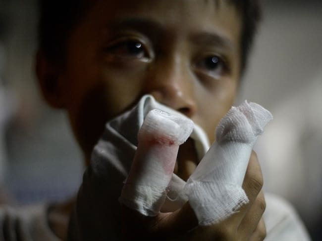 En la noche de fin de año se registraron 2 casos de lesionados con pólvora en el departamento.. Foto: Getty Images