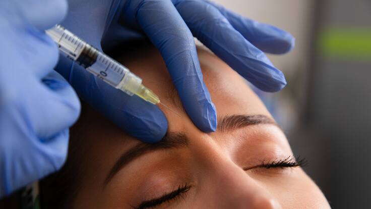 ¿Es bueno inyectarse colágeno en el rostro? dermatóloga explicó el proceso