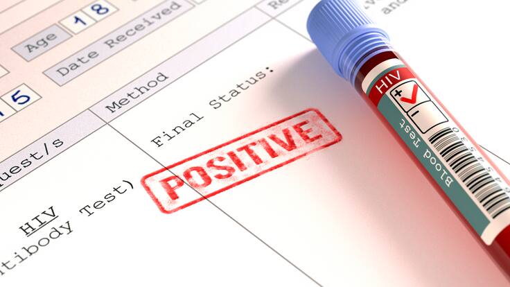 “El VIH, hoy en día, no es una sentencia de muerte”: Experto explicó tratamientos de este virus