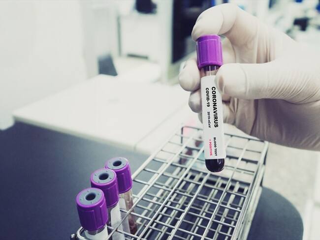 Casos de COVID-19 en Colombia. Foto: Getty Images