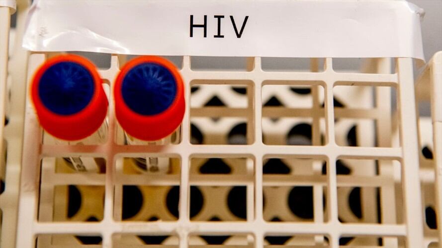 Científicos advirtieron que el caso debe ser verificado y estudiado minuciosamente antes de hablar de una cura. Foto: Getty Images