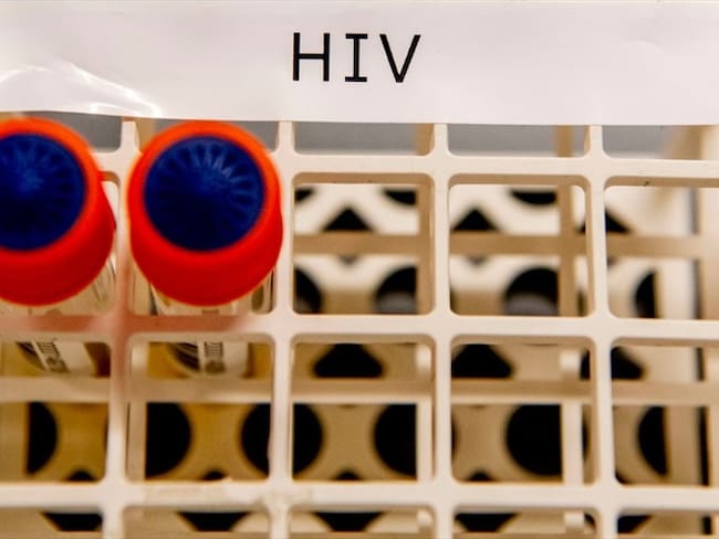 Científicos advirtieron que el caso debe ser verificado y estudiado minuciosamente antes de hablar de una cura. Foto: Getty Images