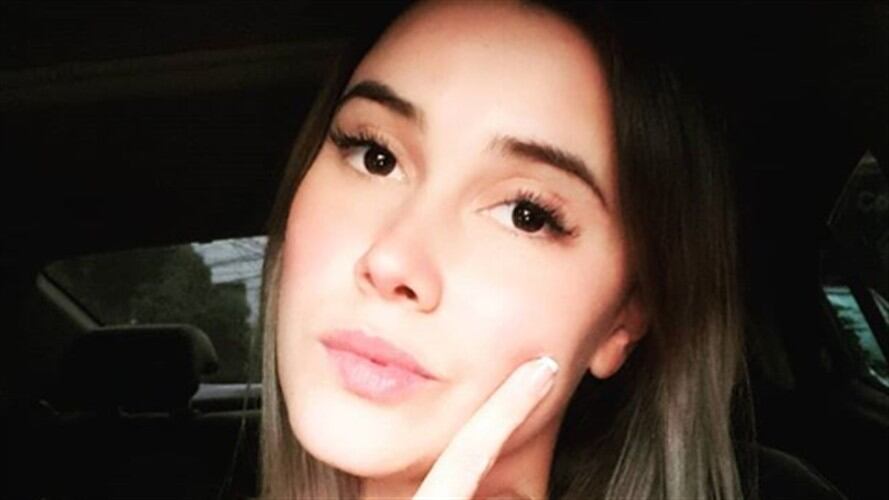 Contó su mala experiencia con el procedimiento de diseño de sonrisa.. Foto: Instagram: manugomezfranco1