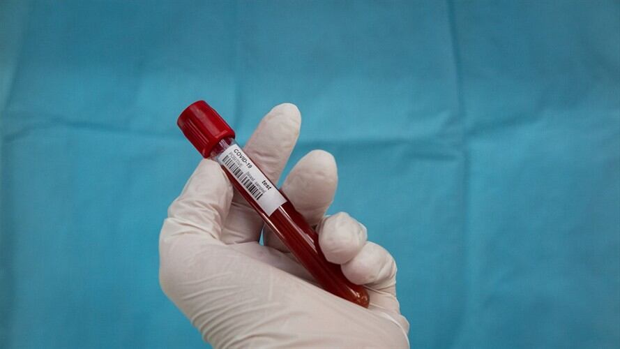 Ciertos tipos de sangre serían más fuertes al virus, mientras que otros estarían predispuestos a generar complicaciones.. Foto: Getty Images