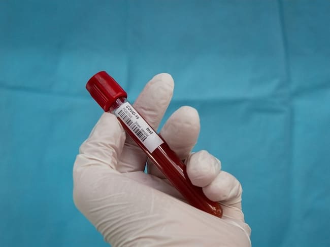Ciertos tipos de sangre serían más fuertes al virus, mientras que otros estarían predispuestos a generar complicaciones.. Foto: Getty Images