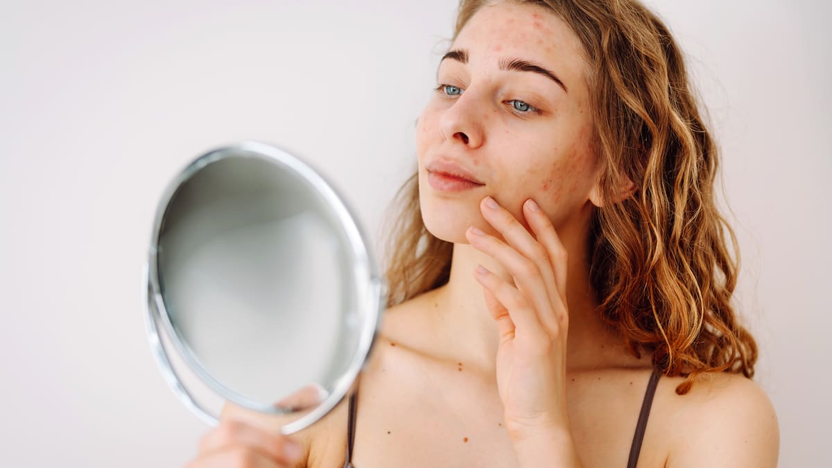 Dermatólogo revela cuáles son las enfermedades que atacan la piel