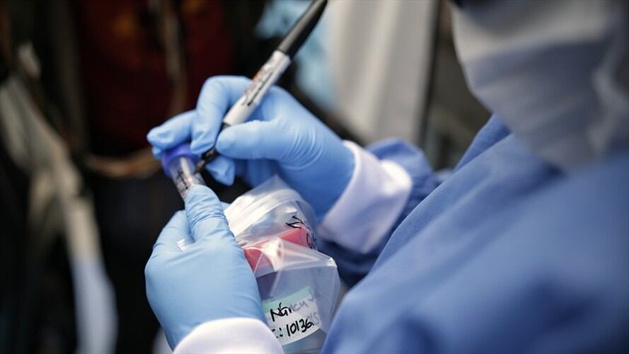 Casos de COVID-19 en Colombia. Foto: Colprensa