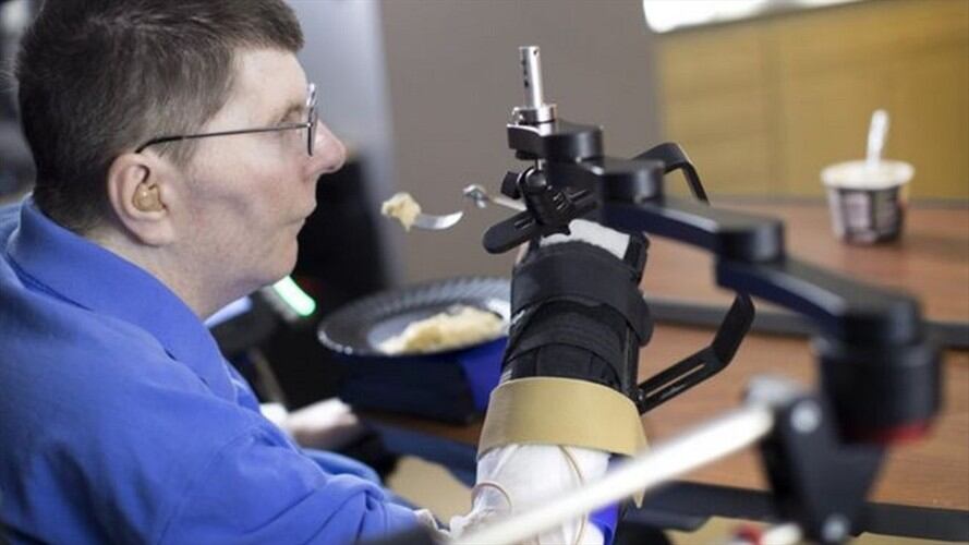 La técnica se puso a prueba con Bill Kochevar, de 53 años, que se quedó tetrapléjico hace ocho años tras un accidente de bicicleta.. Foto: BBC Mundo