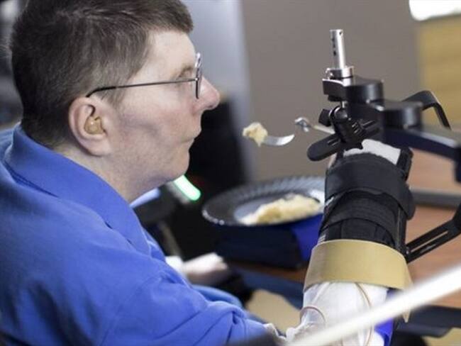 La técnica se puso a prueba con Bill Kochevar, de 53 años, que se quedó tetrapléjico hace ocho años tras un accidente de bicicleta.. Foto: BBC Mundo