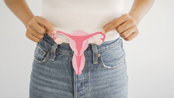 “Una de cada cinco mujeres tiene ovario poliquístico": experto explicó qué es este síndrome