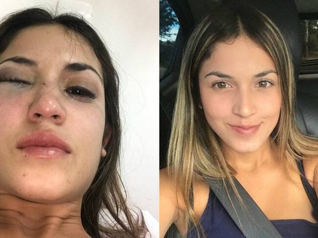 La modelo y abogada Leidy Franco denunció brutal agresión en Popayán. Foto: Cortesía Leidy Franco