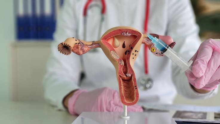 ¿Las infecciones vaginales se generan por enfermedades de transmisión sexual? Experta explicó