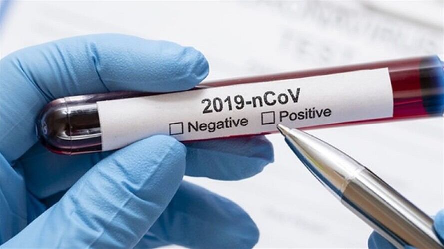 Casos COVID-19 en Colombia. Foto: Colprensa