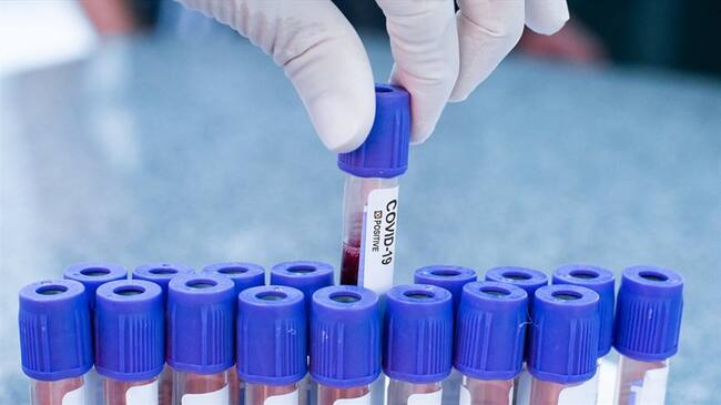 Casos de Coronavirus en Colombia. Foto: Getty Images