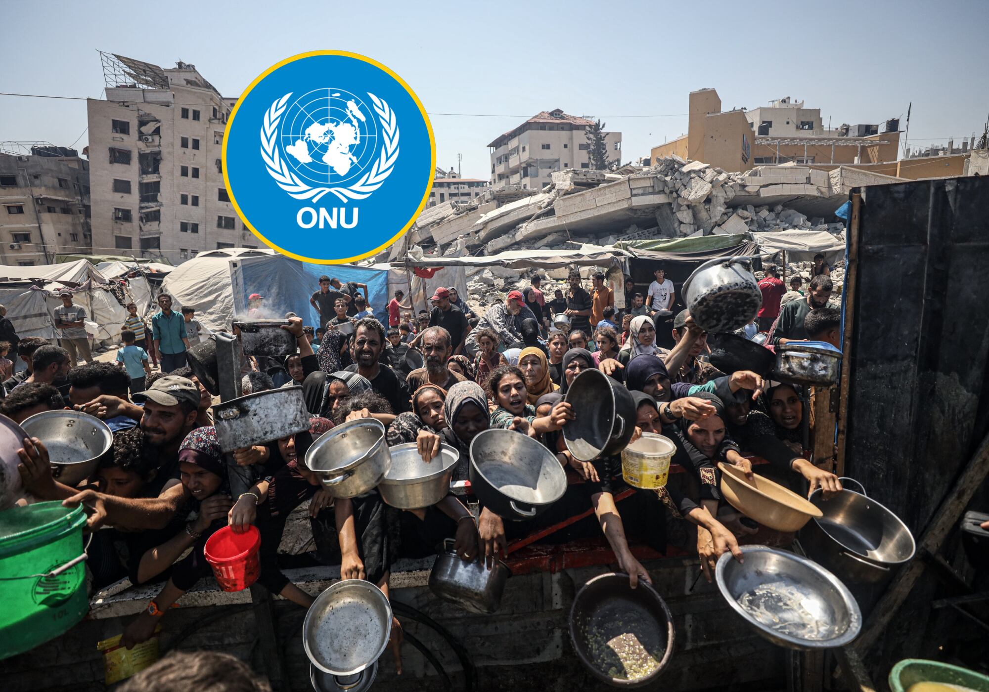 Hambruna en Gaza. Fotos: Getty Images.