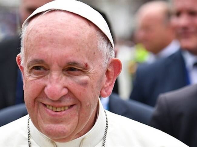 El momento en que el papa Francisco se golpea con uno de los parales del papamóvil. Foto: Getty Images
