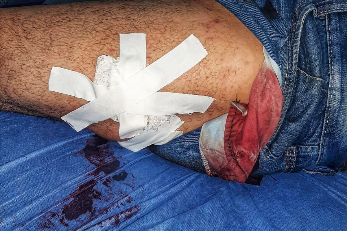 Dos trabajadores más resultaron heridos. Crédito: Red de Apoyo Cauca. 