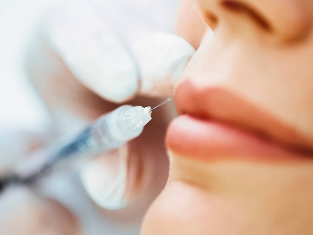 Médico revela los miedos más latentes frente a tratamientos estéticos: ¿cómo evitarlos?