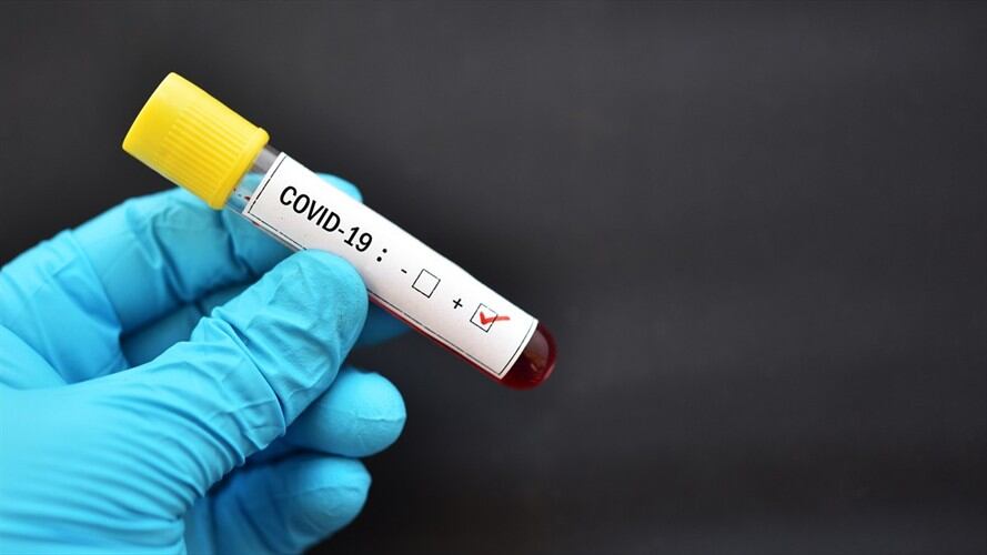 Imagen de referencia. Foto: Getty Images