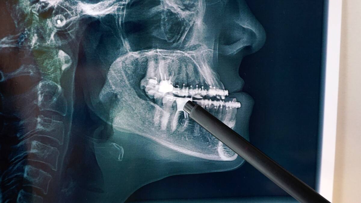 ¿Un problema maxilofacial puede causar dolores de cabeza? Odontólogo explicó