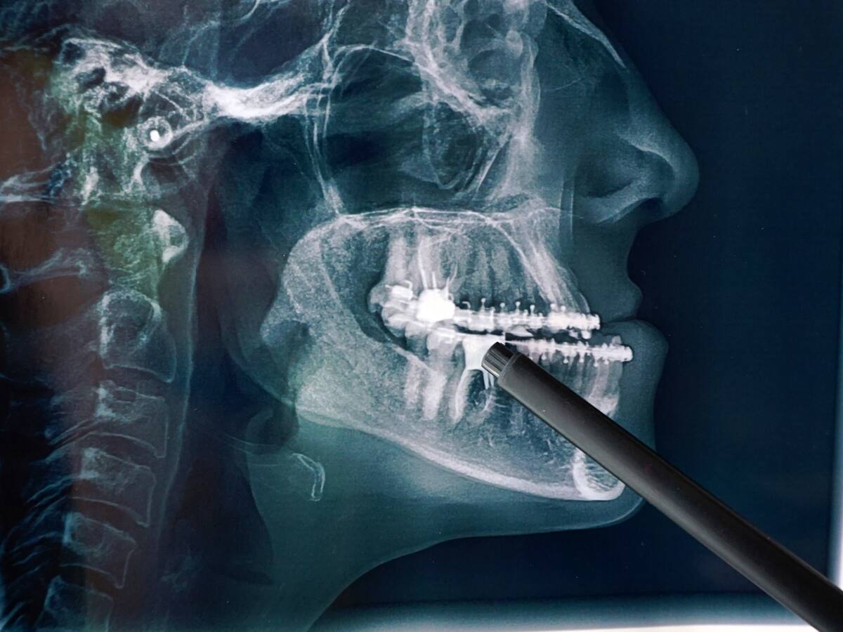 ¿Un problema maxilofacial puede causar dolores de cabeza? Odontólogo explicó