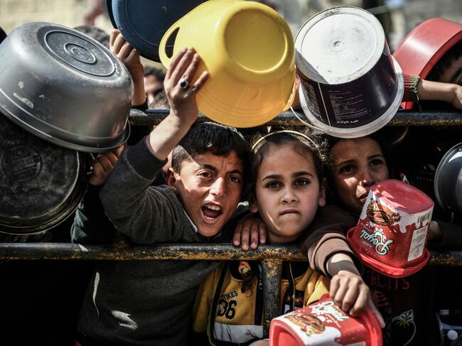 La Sanidad gazatí denunció otras 14 muertes relacionadas con la desnutrición en la Franja .EFE/ Eyad El Baba/UNICEF/