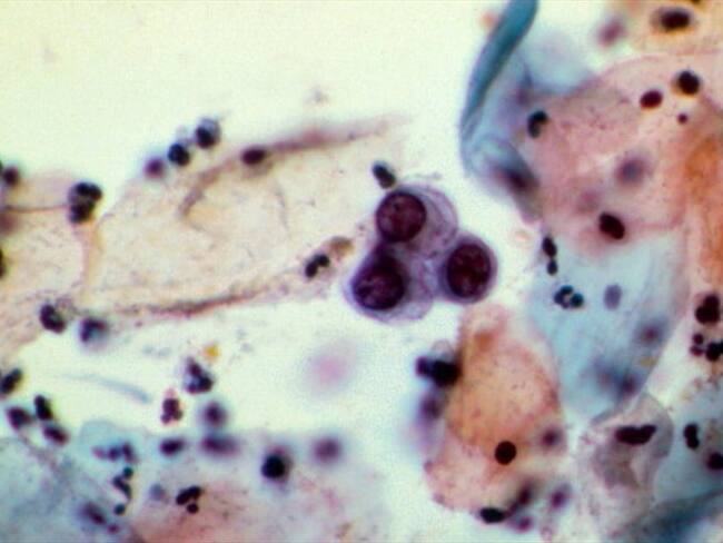 Imagen de referencia. Foto: Getty Images