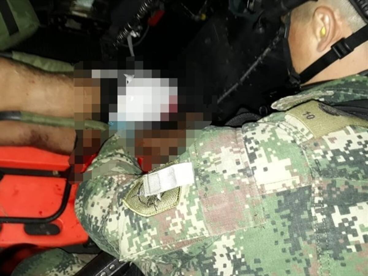 Menor de edad resultó afectado por mina antipersonal en el sur de Córdoba