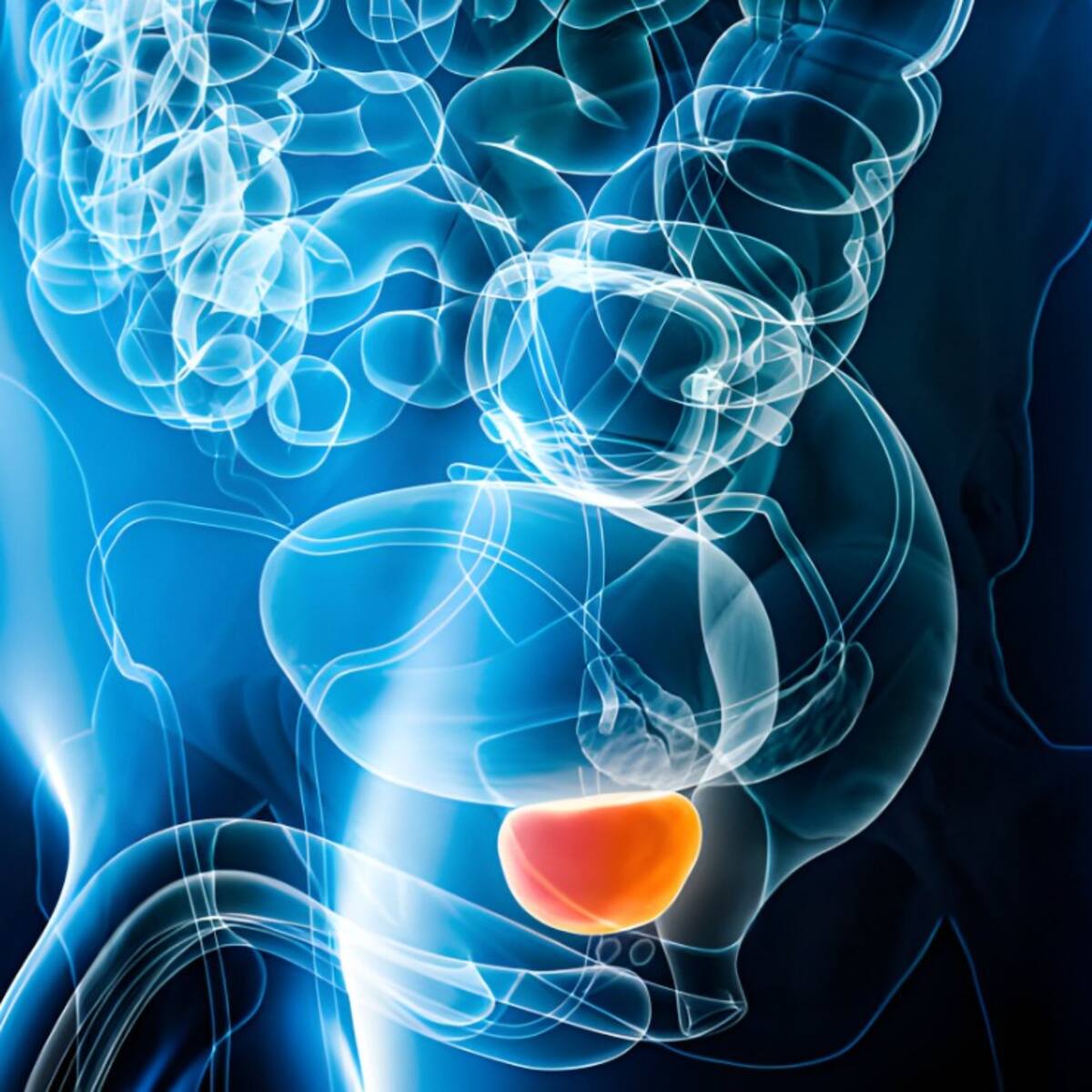 Mitos y verdades del cáncer de próstata, urólogo explicó detalles