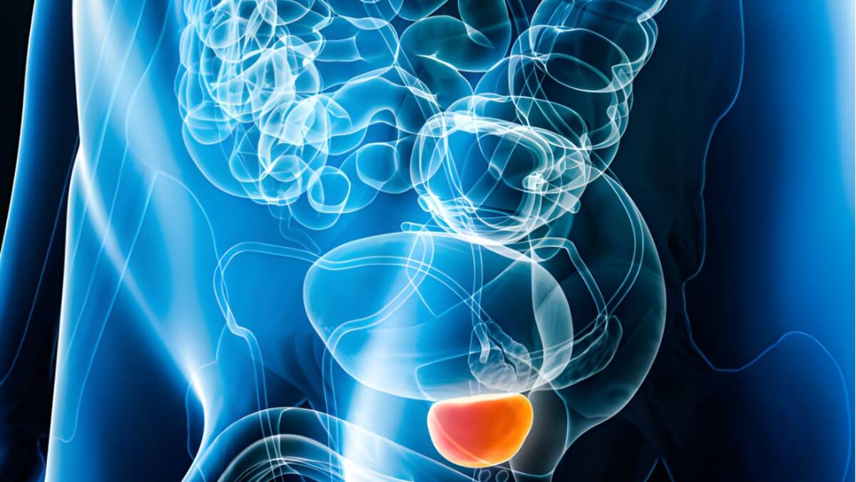 Urólogo aclaró todos los mitos relacionados con el cáncer de próstata