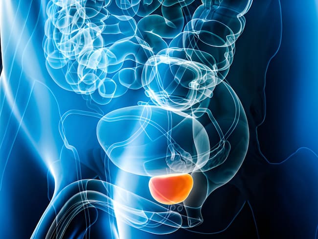 Urólogo aclaró todos los mitos relacionados con el cáncer de próstata