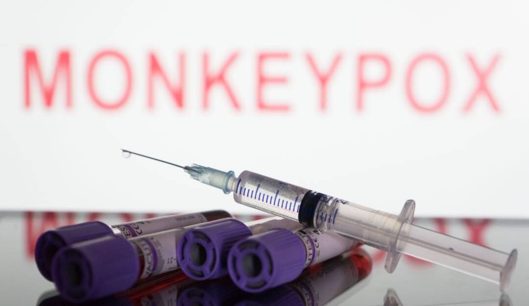 Vacunas en contra del viruela del mono. Foto: Getty