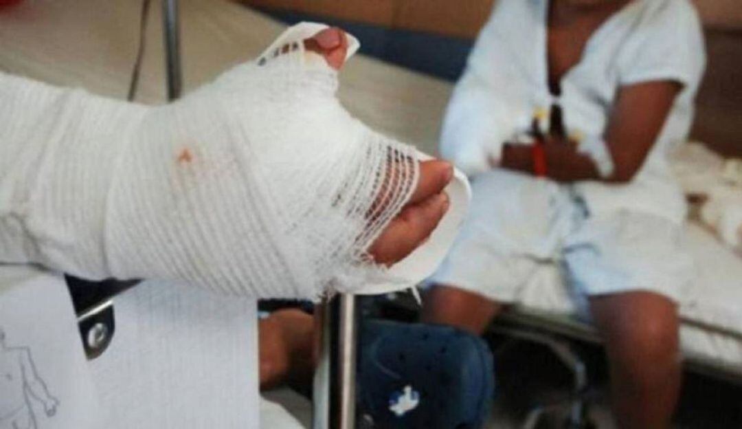 quemados por pólvora 