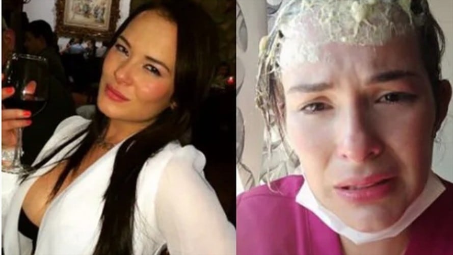 La mujer fue víctima de una agresión con pegamento corrosivo mejor conocida como "el champú".. Foto: Facebook