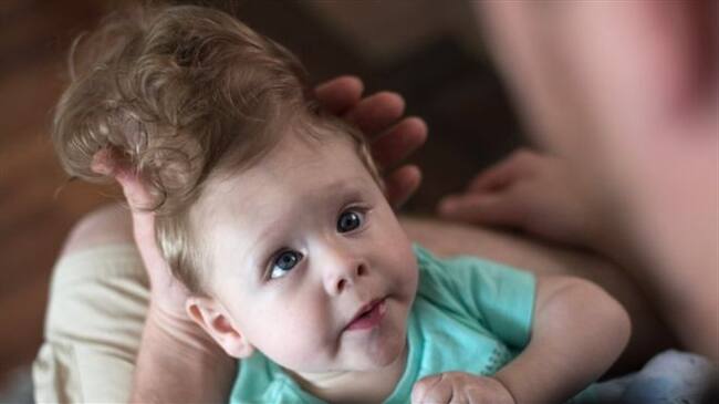 Los médicos les dijeron a los padres de Bentley que su hijo no sobreviviría. Foto: C. COHEN/HOSPITAL INFANTIL DE BOSTON / BBC MUNDO.