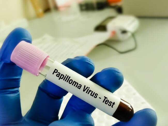 Virus del papiloma humano. Foto: Getty Images
