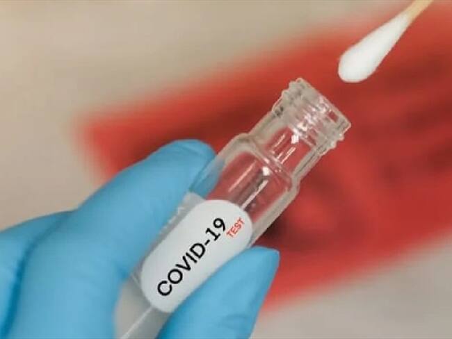 Vacuna del covid -19 . Foto:Suminsitrada.