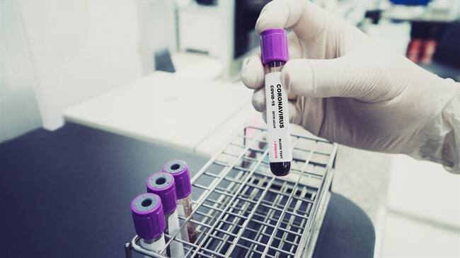 Casos de COVID-19 en Colombia. Foto: Getty Images