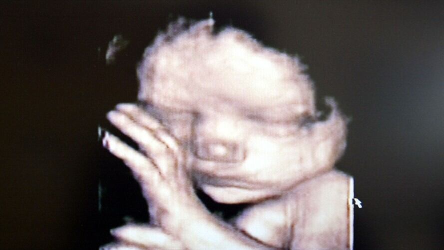 Esta determinación se tomará tras el estudio de una tutela que interpuso una mujer de 26 semanas de embarazo. Foto: Getty Images