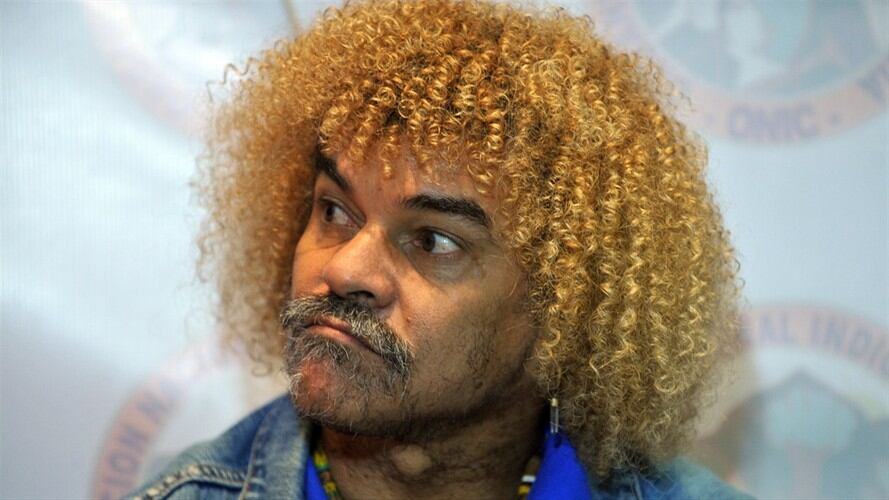 “Es momento de unirse como equipo”: ‘El Pibe’ Valderrama a los jugadores de la Selección. Foto: AFP PHOTO/Guillermo Legaria