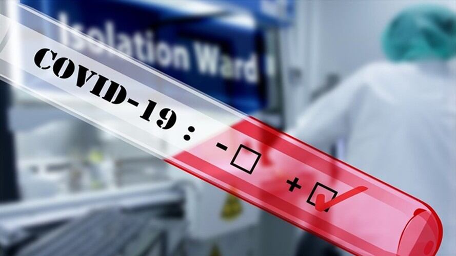 En Colombia van cuatro muertos por la pandemia y 470 casos confirmados.. Foto: Pixabay