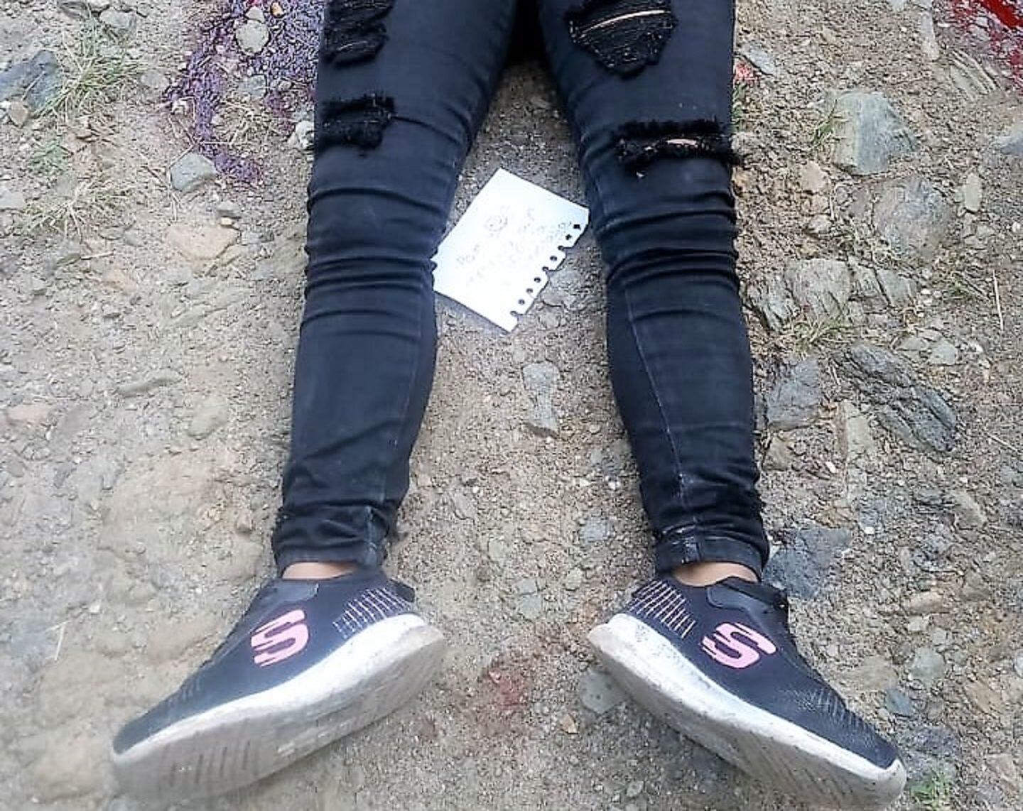 Hombres armados dispararon en dos oportunidades contra la mujer de 18 años: Crédito Cric.