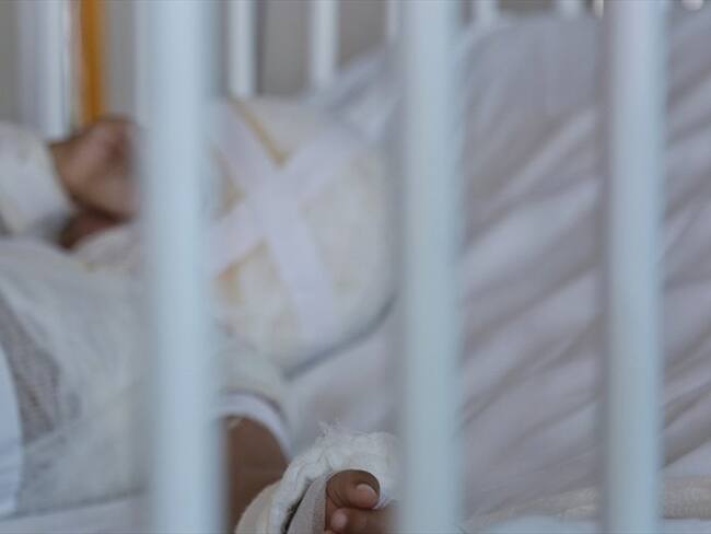 Directora del Icbf expuso que el 25% de los quemados por pólvora son niños