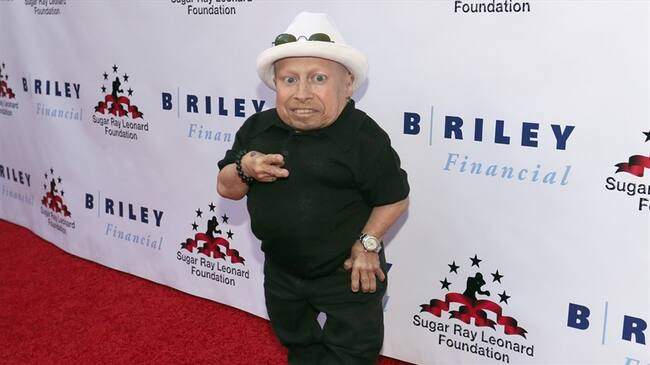 El actor de 'Austin Powers' Verne Troyer. Foto: Getty Images.