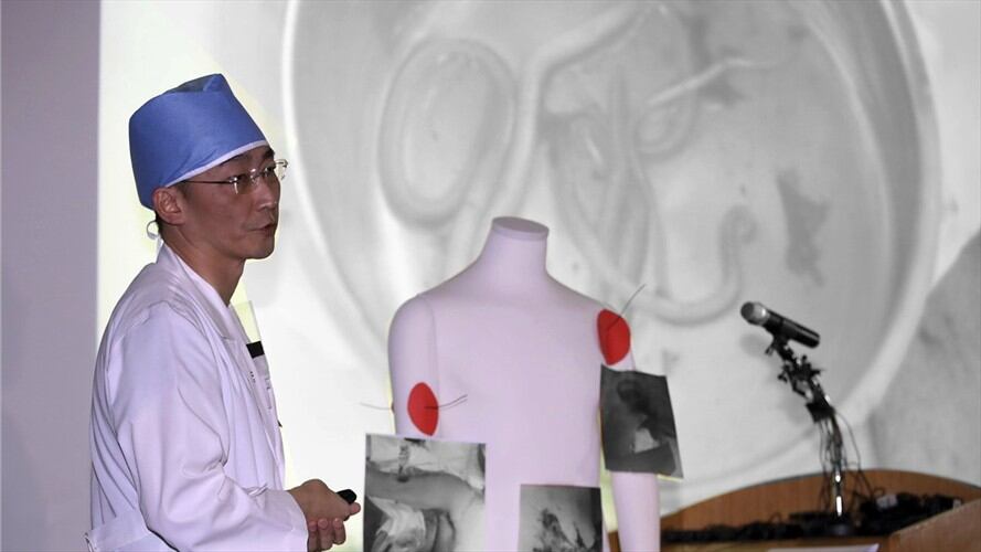 Detectan enormes parásitos en soldado que huyó de Norcorea. Foto: Associated Press - AP